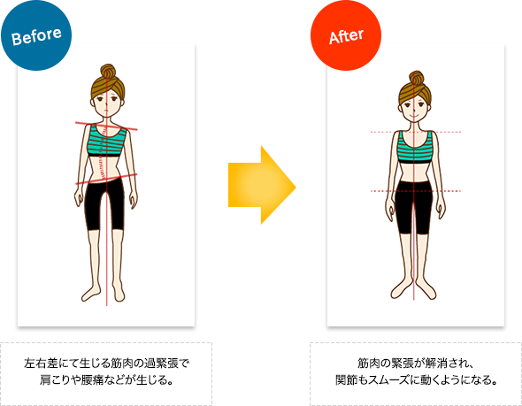 当院独自の施術法全身を整え身体の歪みを取り除く「LRB骨格調整」