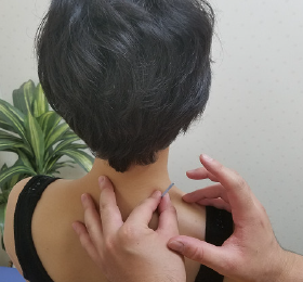 鍼治療で凝り固まった筋肉の血液循環を促進