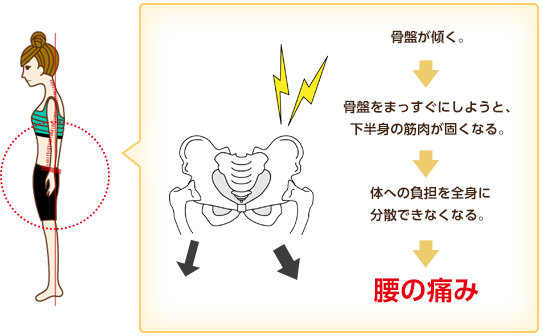 腰の痛みは骨盤の開きが原因